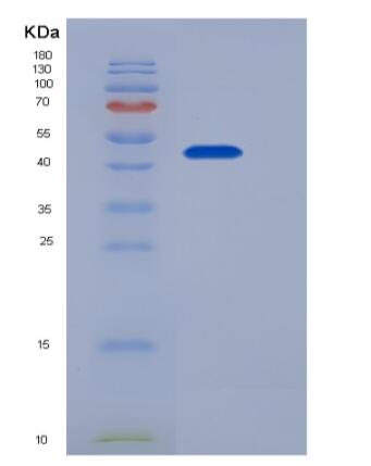 Recombinant Mouse Epcr / PROCR Protein (Fc tag)