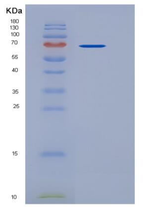 Recombinant Human CD4 / LEU3 Protein (His & Fc tag)