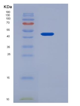 Recombinant Human AMIGO2 Protein (His tag)