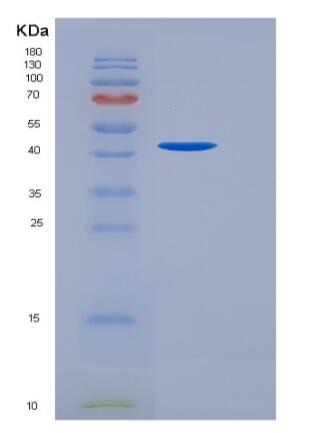 Recombinant Human TGFBR2 Protein (His &Fc Tag)