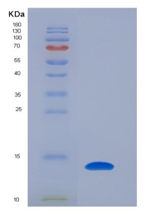 Recombinant Human KIAA0101 / p15 / PAF Protein (His tag)