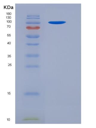 Recombinant Mouse VCL / Vinculin Protein (His tag)