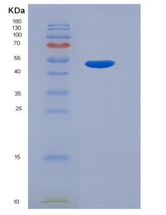 Recombinant Human PNLIP Protein (His tag)