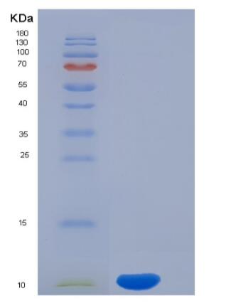 Recombinant Human CD3d / CD3 delta Protein (His tag)