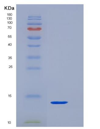 Recombinant Human CD3 epsilon / CD3e Protein (His Tag)