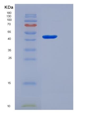 Recombinant Human Gastric intrinsic factor / GIF Protein (His tag)