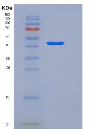 Recombinant Human Dehydropeptidase-I / DPEP1 Protein (His tag)