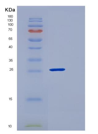 Recombinant Human CLEC12A / CLL-1 / DCAL2 Protein (His tag)