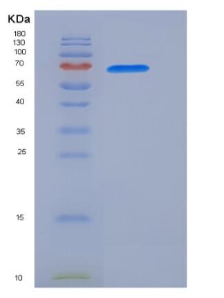 Recombinant Human GAD67 / GAD1 Protein (His tag)