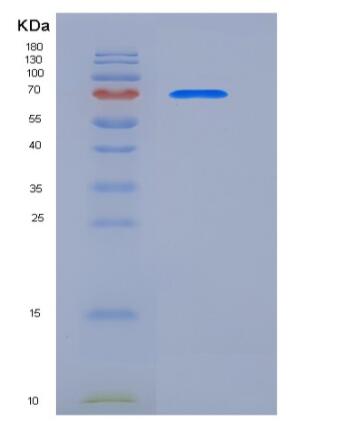Recombinant Human CALR / Calreticulin Protein (Fc tag)