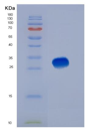 Eukaryotic Cluster Of Differentiation 147 (CD147)