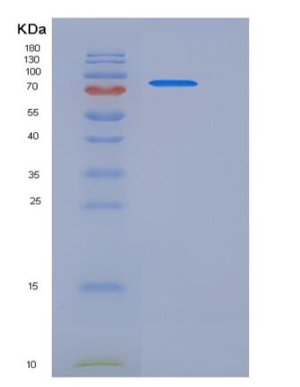 Recombinant Human LDLR Protein (His Tag)