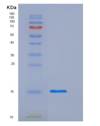 Recombinant Human L-FABP / FABP1 Protein (His tag)