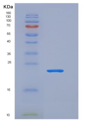 Recombinant Human LCN2 / NGAL Protein (His tag)