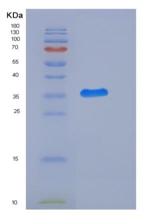 Recombinant Rat CD111 / Nectin-1 / PVRL1 Protein (His tag)