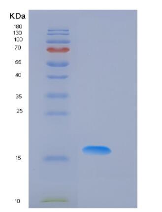 Recombinant Mouse Fas Protein (His Tag)