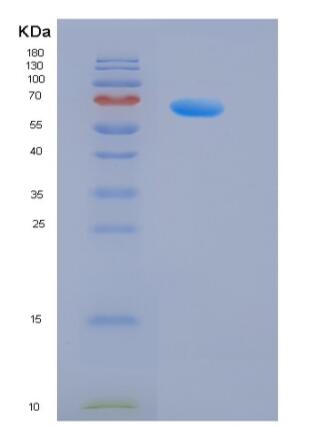 Recombinant Rat HER2 / ErbB2 Protein