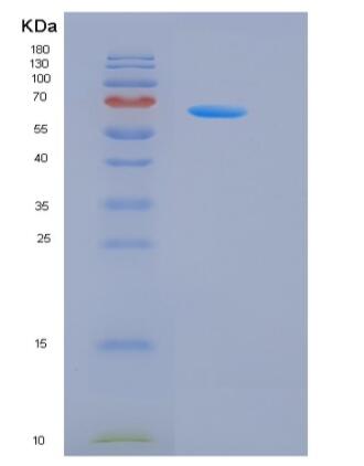 Recombinant Human G-CSFR / CD114 / CSF3R Protein