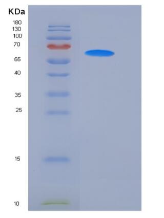 Recombinant Mouse CD14 Protein (His & Fc tag)