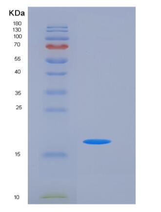 Recombinant Human NBL1 / DAND1 / DAN Protein (His tag)