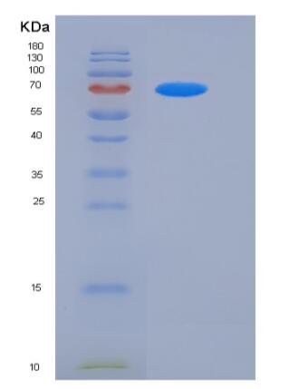 Recombinant Rat Her2 / ERBB2 Protein (His Tag)