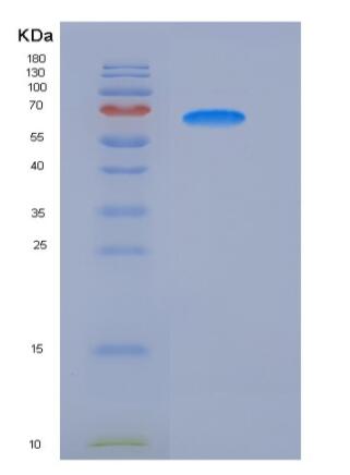 Recombinant Human G-CSFR / CD114 Protein (His tag)