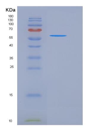 Recombinant Human SIGLEC6 / CD327 Protein (Fc tag)