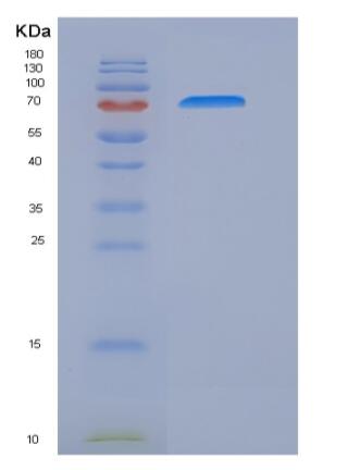 Recombinant Human IL17RC Protein (Fc tag)