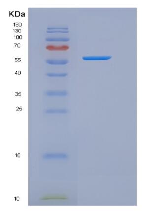 Recombinant Human IL17RA / CD217 Protein (His & Fc tag)