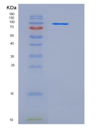 Recombinant Human G-CSFR / CD114 / CSF3R Protein (Fc tag)