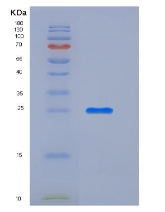 Recombinant Mouse CXADR Protein (His tag)