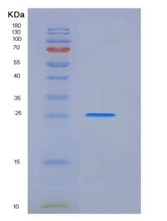 Recombinant Rat PRLR / Prolactin receptor Protein (His tag)