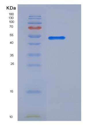 Recombinant Mouse B7-H4 / B7S1 / B7x Protein (Fc tag)