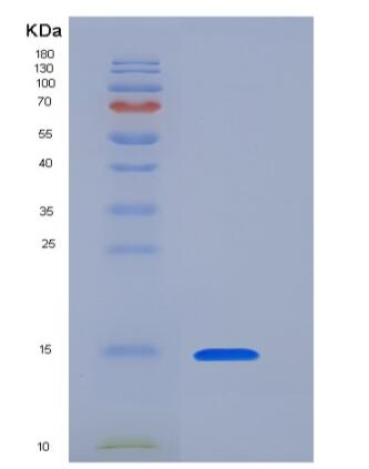 Recombinant Human Dectin-1 Protein