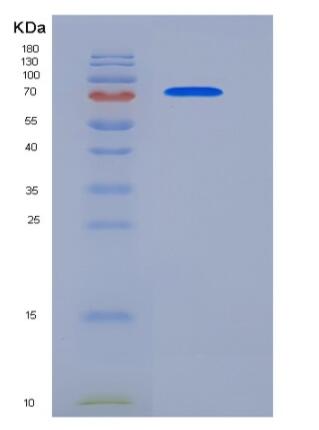 Recombinant Human ECE1 Protein (His tag)