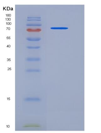 Recombinant Human PROS1 / Protein S Protein (His tag)