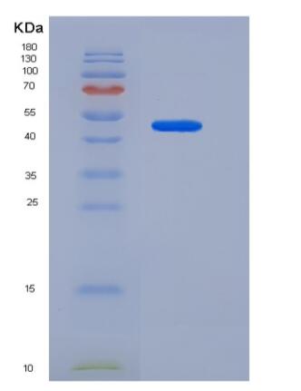 Recombinant Human CD31 / PECAM1 Protein (His tag)