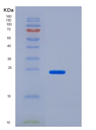 Recombinant Human CD200 / OX-2 Protein (His tag)