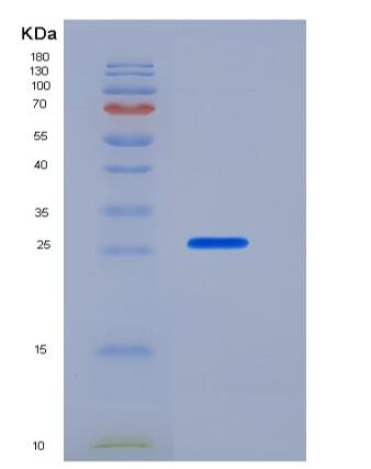 Recombinant Mouse PD-L1 Protein (His Tag)