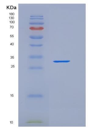 Recombinant Human TIM4 / TIMD4 Protein (His tag)