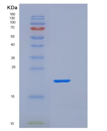 Recombinant Human Fc γ RIIa/FCGR2A/CD32a Protein(C-6His)