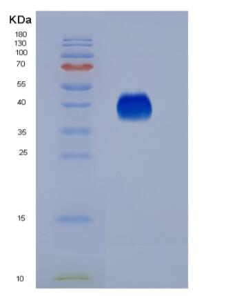 Eukaryotic Fc Fragment Of IgG Low Affinity IIIa Receptor (FcgR3A).