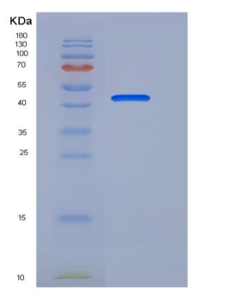 Recombinant Human ENPP7 / NPP-7 Protein (His tag)