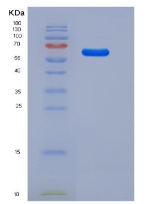 Recombinant Rat LAMP1 / CD107a Protein (Fc tag)