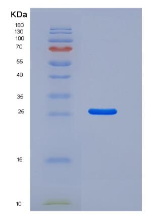 Recombinant Human Kallikrein 6 Protein (His Tag)