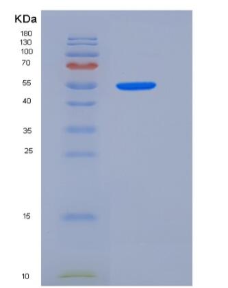 Recombinant Rat GPT1 / GPT Protein (His tag)