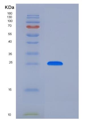 Recombinant Human GLIPR1 Protein (His Tag)