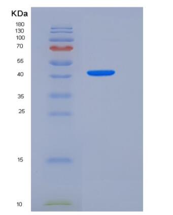 Recombinant Human DDR2 Kinase / CD167b Protein (His tag)