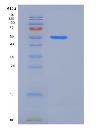 Recombinant Rat KIRREL3 / NEPH2 Protein (His tag)