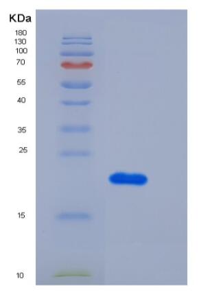 Recombinant Human TNFRSF1A Protein (His Tag)